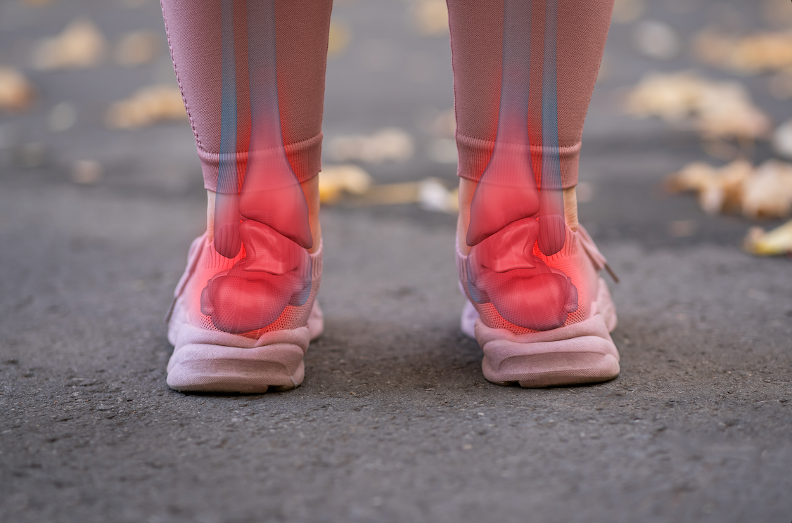 How do I know I have flat feet? - Chiappetta Shoes