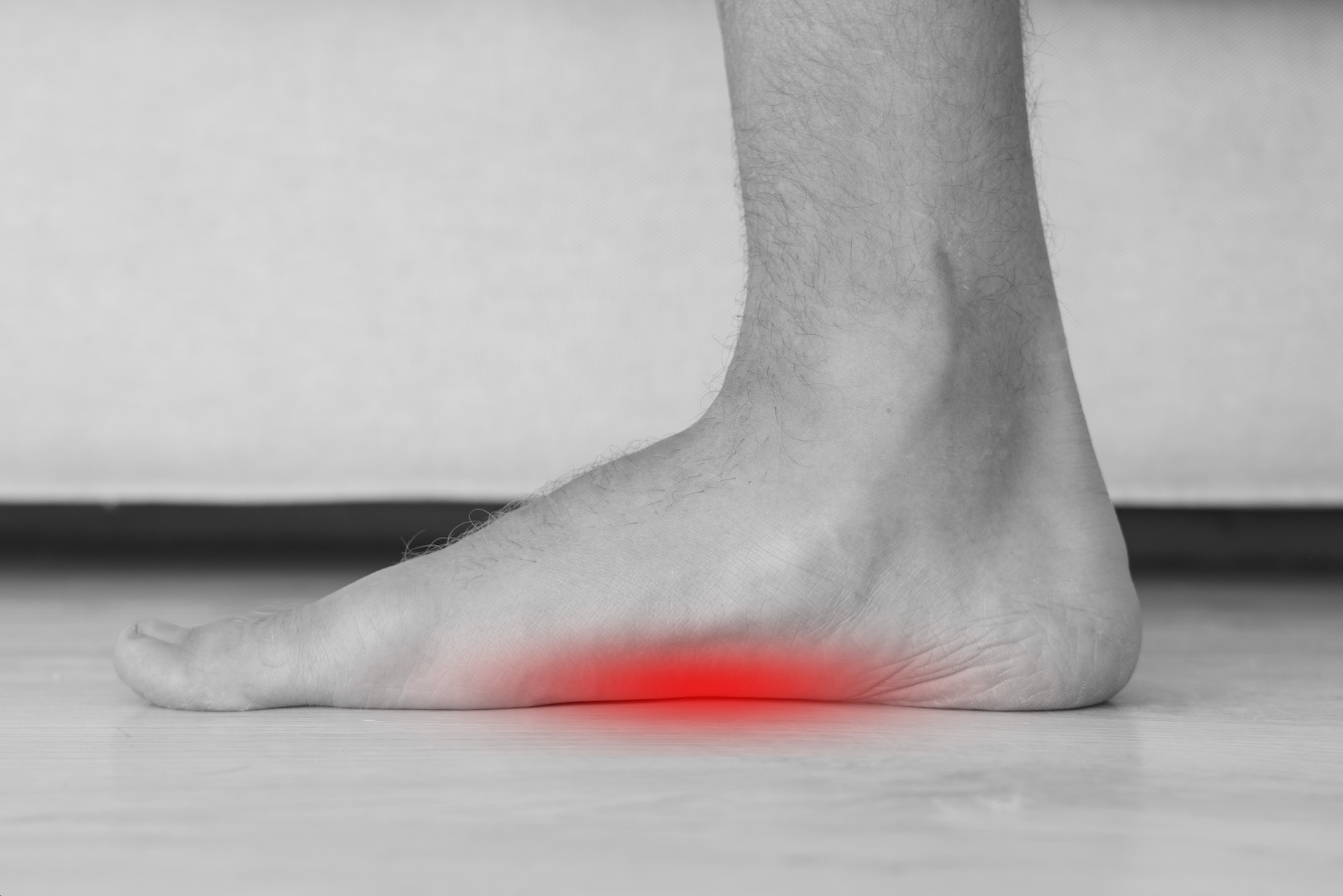 Foot illustrating underfoot pain